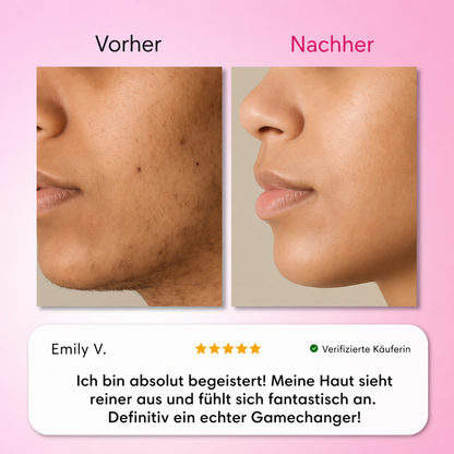 Natürlicher Haarwuchsstopp
