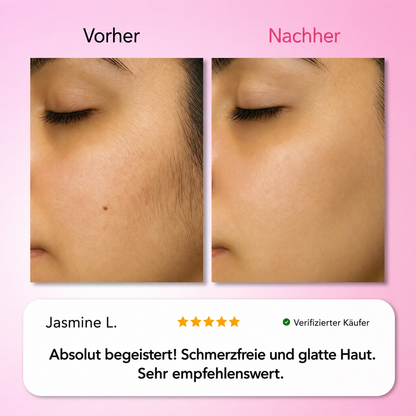 Natürlicher Haarwuchsstopp
