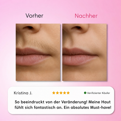 Natürlicher Haarwuchsstopp